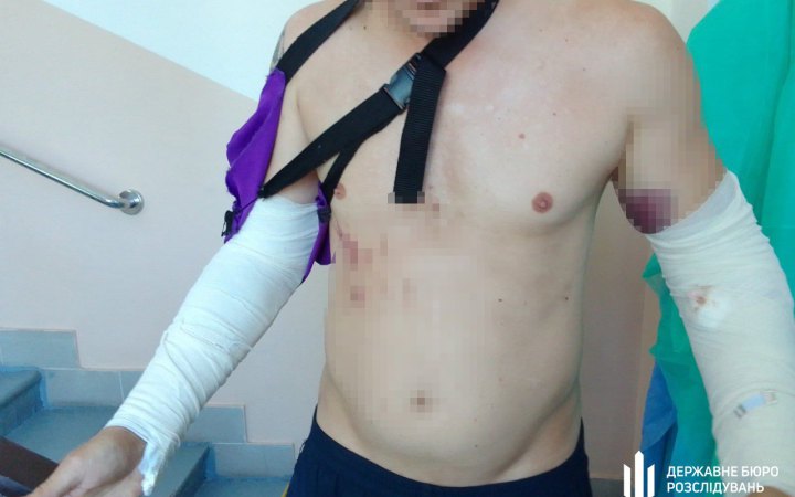 ДБР повідомило про підозру інструктору, який побив курсанта на навчаннях