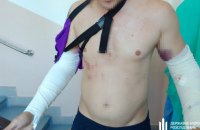 ДБР повідомило про підозру інструктору, який побив курсанта на навчаннях