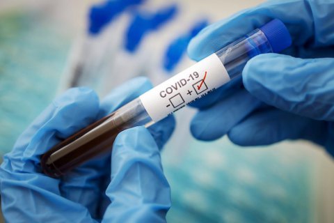 У неділю в Україні зафіксували 8832 нові випадки коронавірусу