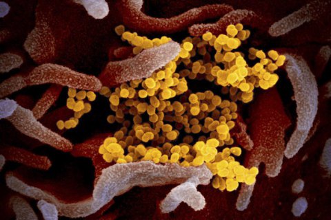 Количество инфицированных коронавирусом в мире превысило 128 тыс. человек, 70 тыс. выздоровели