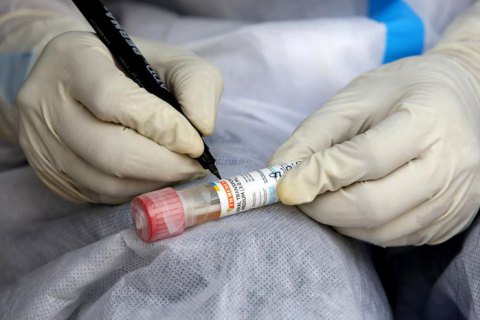 За липень найбільшу кількість хворих на коронавірус по країні виявили у Львівській області