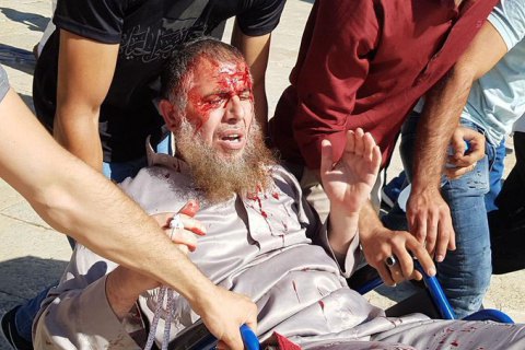 ​На Храмовой горе в Иерусалиме вспыхнули беспорядки, есть пострадавшие