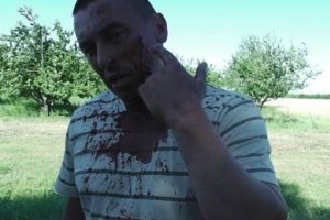 Милиция задержала трех участников драки на "Агрофирме Корнацких"