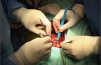 Девятилетней американке пересадили шесть органов