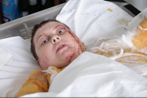 Поліція кваліфікує напад на Гандзюк як убивство