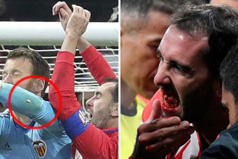 Воротар "Валенсії" вибив кілька зубів капітану "Атлетіко" під час матчу