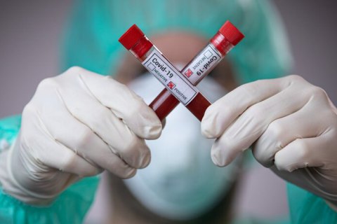 В Украине зафиксировано 299 новых случаев коронавируса