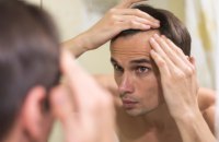 Чому чоловіки лисіють і які методи існують для профілактики та лікування: NYT