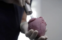 Українським військовим витягують уламки з серця і не лише саморобними магнітами, — BBC 