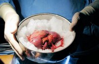 Силовики зловили групу чорних трансплантологів
