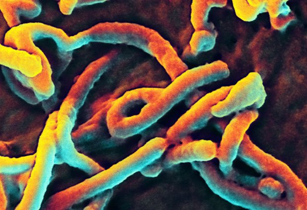 Электронная микрофотография вируса Эболы