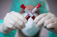 В Україні зафіксовано 299 нових випадків коронавірусу