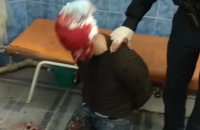 Участник драки в центре Одессы напал на врачей скорой помощи
