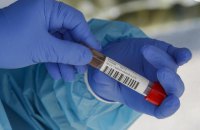 Уряд Чехії зобов’язав компанії тестувати своїх працівників на коронавірус