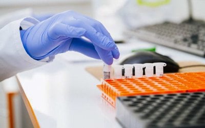 Безоплатні аналізи українцям від Synevo та CSD: чому лабораторії подали на державу до суду 