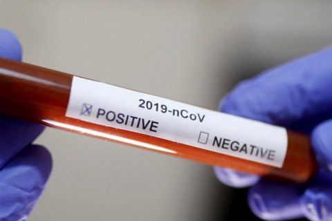 В Україні діагностували ще два випадки коронавірусу