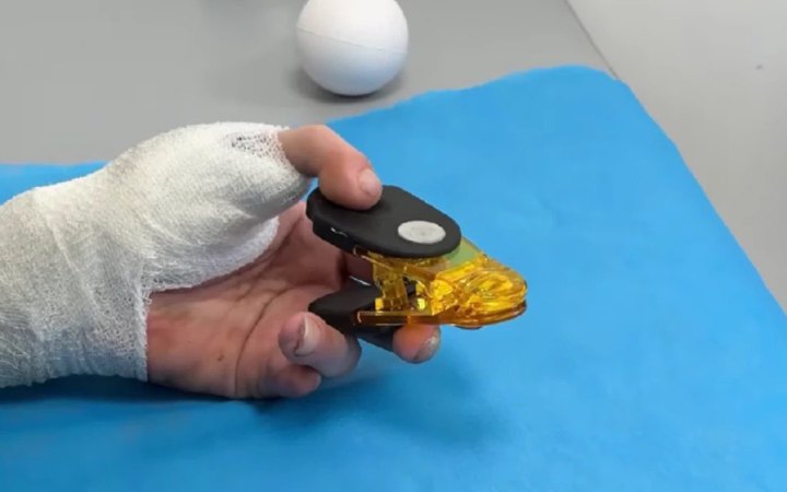 Пересадка з ноги на руку, вживлення електрода у серце, обдурення імунітету – 10 неординарних медичних кейсів 2025 року 