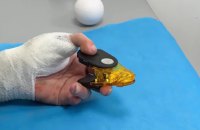 Пересадка з ноги на руку, вживлення електрода в серце, обдурення імунітету — 10 неординарних медичних кейсів 2025 року