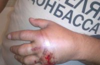 В милиции ничего не знают о ранении мужчины в футболке "Спасибо жителям Донбасса" 