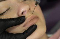 У Запоріжжі жінка захворіла на ботулізм після відвідування косметологічної процедури: що сталося 