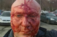 Известного киевского догхантера Святогора жестоко избили после суда