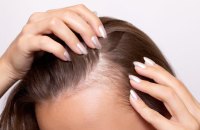 «Волосся сиплеться, нігті ламкі — здам аналіз на феритин»: пояснюємо про дефіцит заліза та його симптоми