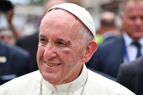 Папа Римский получил травму во время визита в Колумбию