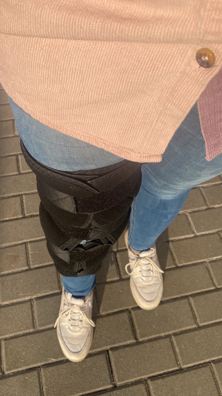 Нога в ортезі