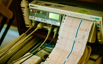 Як не пропустити проблеми з серцем — пояснює кардіологиня Наталія Волкова 