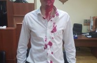 Советника Кличко облили марганцовкой из-за МАФов