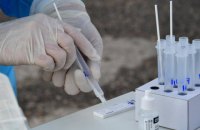 На Кипре обнаружили более 10 случаев инфицирования "британским" штаммом коронавируса