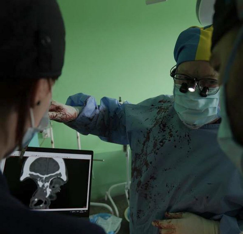 Операція з реконструкції обличчя 