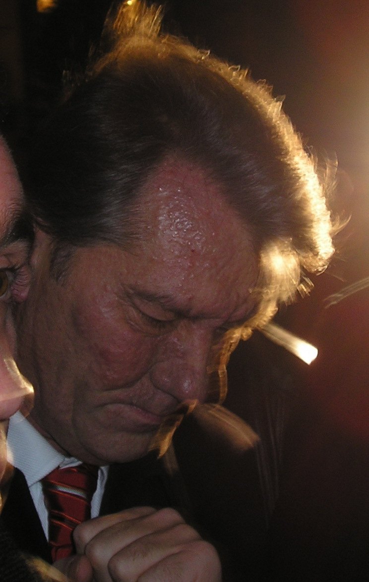 Віктор Ющенко після отруєння. Фотографія жовтня 2004 р., через 1.5 місяці після отруєння