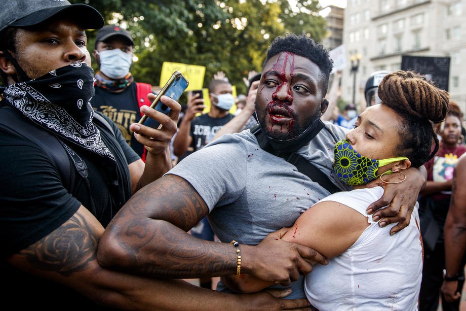 Пострадавший после потасовки с полицейскими во время протестов возле Белого дома , США, 30 мая 2020