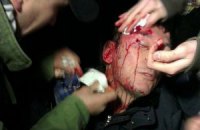 Юрию Луценко разбили голову в потасовке на проспекте Победы (ОБНОВЛЕНО)