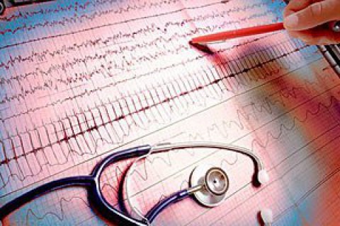 Heart Institute neglects stenting protocols - Health Ministry