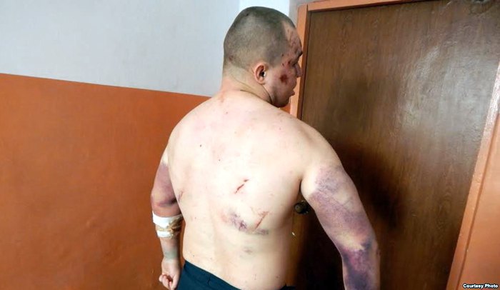 Tortured Mykola Molokov, Berdyansk penal colony 77