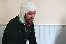Облитый кислотой Чижмарь сомневается, что задержаны виновники покушения