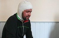Облитый кислотой Чижмарь сомневается, что задержаны виновники покушения