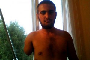 19-летнему бойцу "Айдара" нужна помощь с протезированием