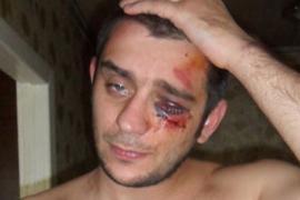 Донецкие милиционеры жестоко избили журналиста