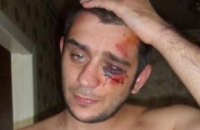Донецкие милиционеры жестоко избили журналиста