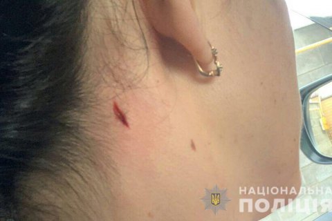 В Николаеве женщина получила ранение, выгуливая собак у полицейского стрельбища