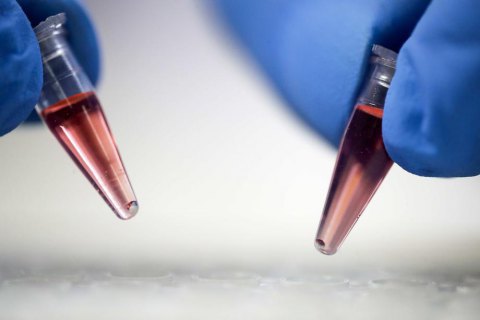 Премьер-министр Бельгии лично лоббировал отмену обязательного тестирования на COVID-19 в Киеве делегации "Брюгге"