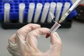 У государства нет денег на качественный гемодиализ