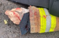 Росіяни обстріляли вже другу пожежну частину у Херсоні, загинув рятувальник (оновлено)