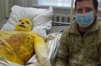 Бойцу с ожогами 80% тела требуется помощь в лечении 