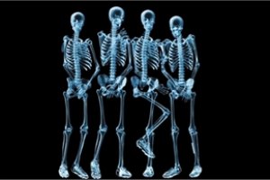 Ученые научились выращивать кости из рыбьей чешуи