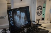Стоматологічні наслідки полону: чи вважається безоплатна реабілітація наданою, якщо людина досі не може говорити і жувати?
