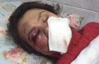 Пашинский: Чорновол в реанимации в очень тяжелом состоянии